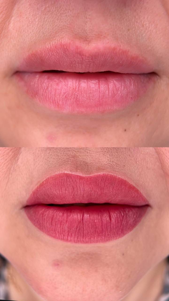 До и после перманента